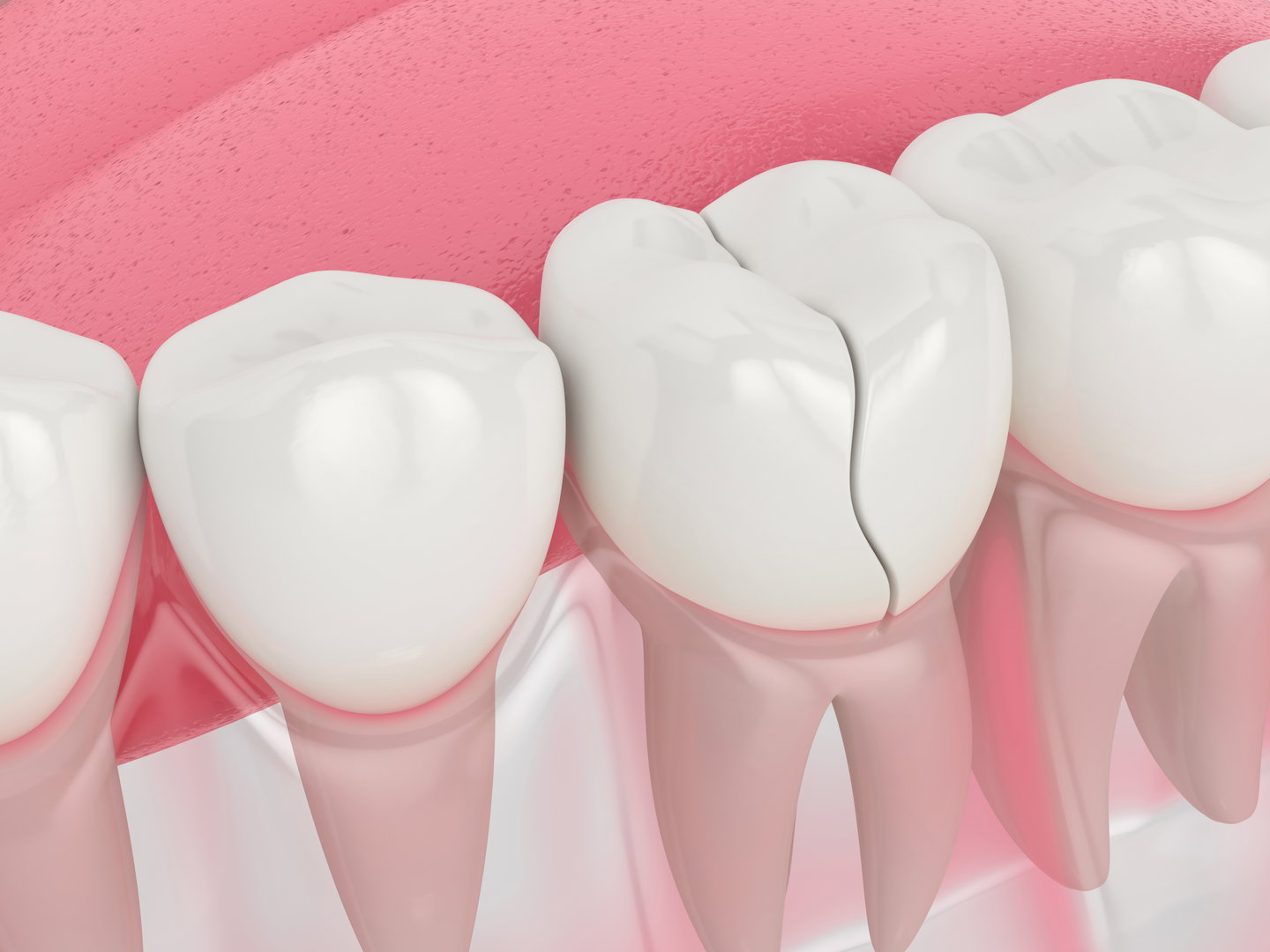 Urgent Dental Appointment