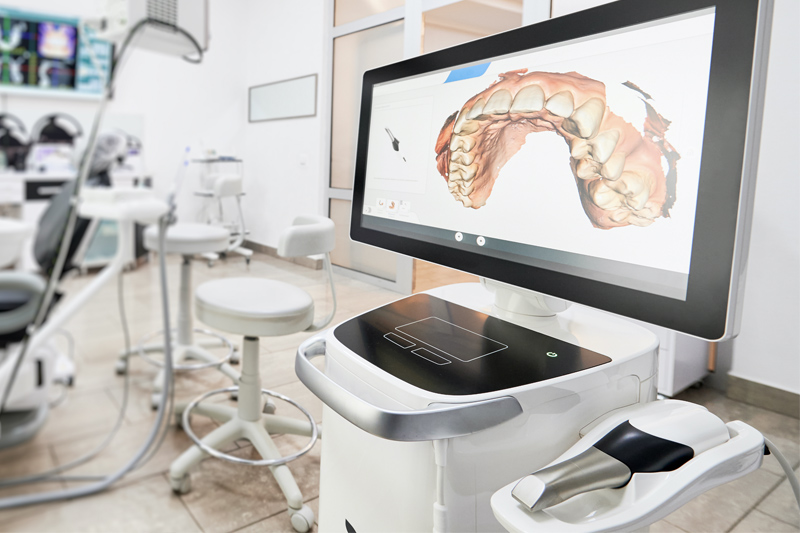 Intra-Oral Scanner in Cypress